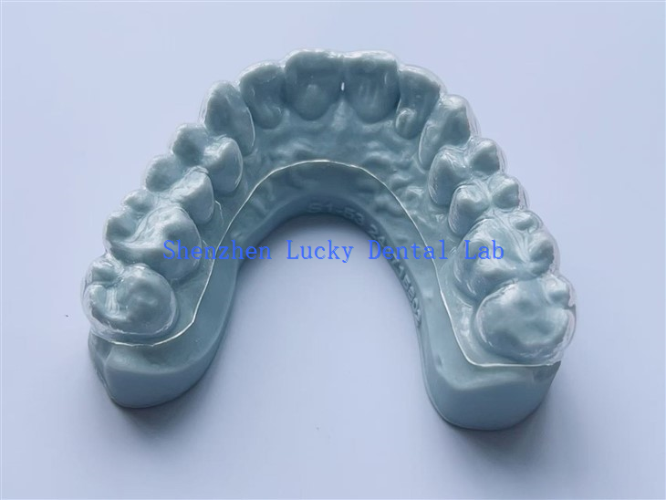 3D Print Bleaching Tray Dental Lab