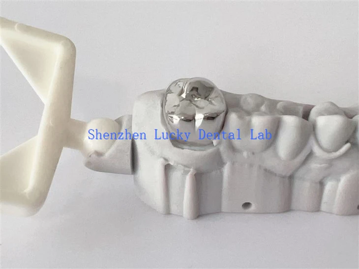 3D Print Dental CoCr Full Metal Crown