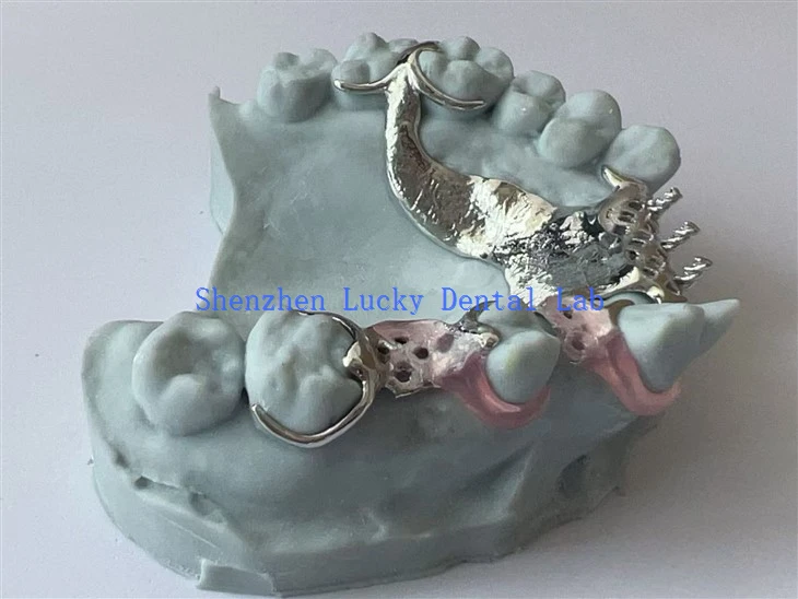 Aesthetic 3D Print Dental Metal Framework with Valplast Clasp Dental Lab