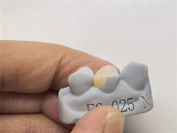 Authentic EMax Inlay/Onlay China Factory