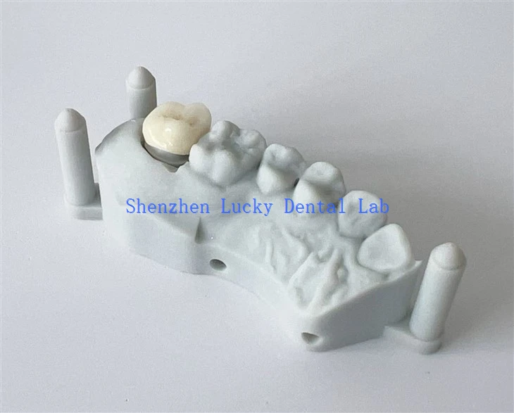 China Dental All Ceramic Zirconia Crown Factory