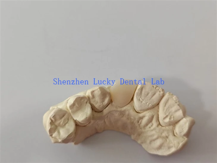 China Dental Zirconia Crown Factory