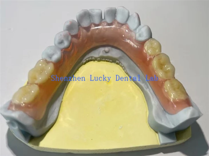Comfortable Partial Flexible Dental Denture Manufacturers
