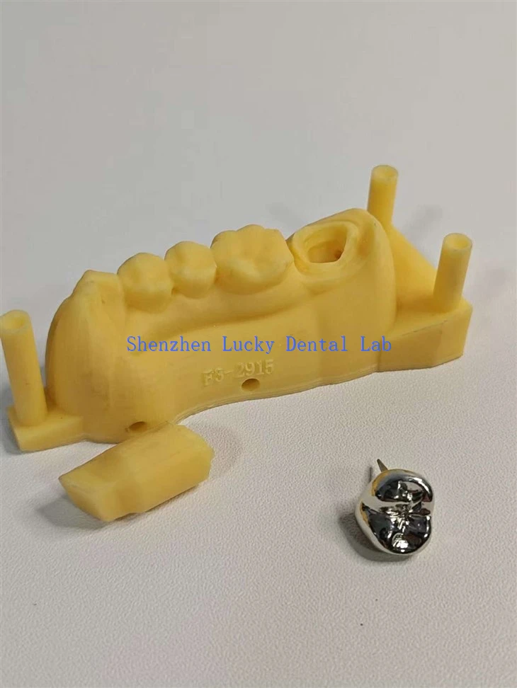 Customized 3D Print Dental FMC Full Metal Crown
