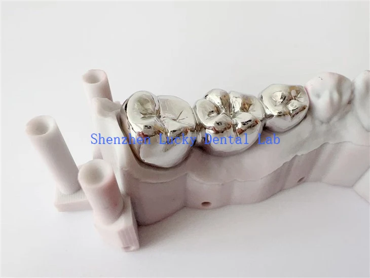 Customized 3D Print Dental Full Metal Crown