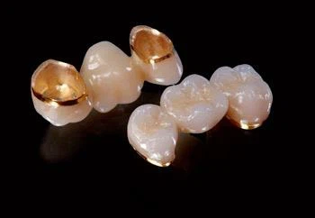 Dental Semi Precious Palladium Gold Crown