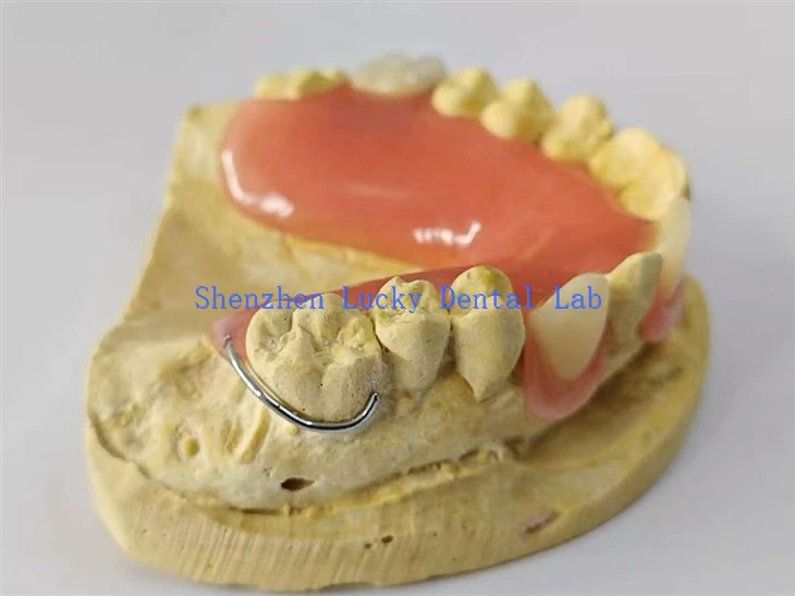 Natural Partial Acrylic Denture with Wire Bent Clasp Dental Lab