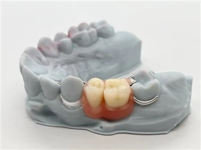3D Print Partial Acrylic Denture With Clear Clasp And Metal Clasp