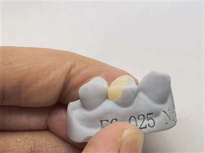 Authentic EMax Inlay/Onlay China Factory