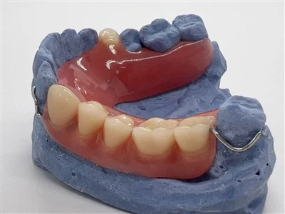 Comfortable Partial Acrylic Denture With Wire Clasp