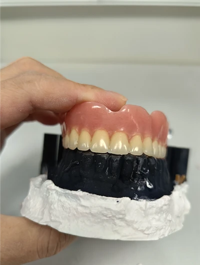 Full Acrylic Denture Try in Outsourcing China Lab