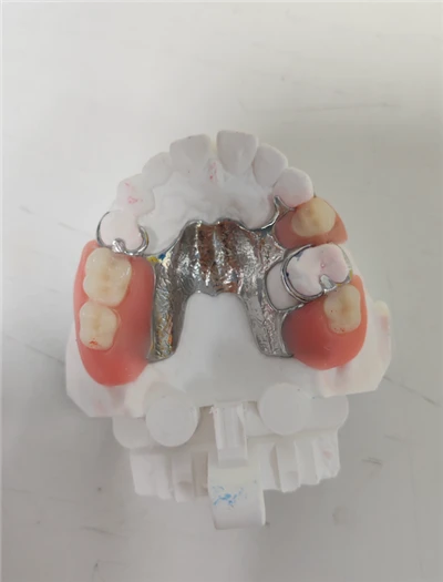 Metal Framework Try in China Dental Lab