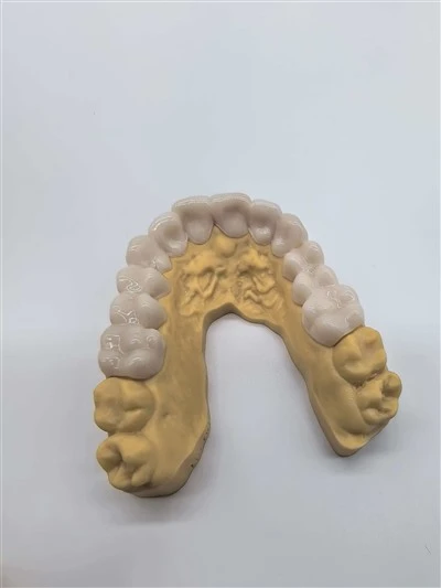 Natural Snap-On Smile