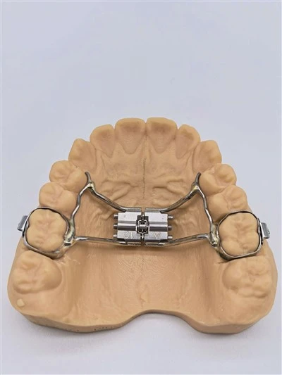 Rapid Palatal Expander RPE Dental Product China