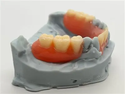 Removable Acrylic Denture
