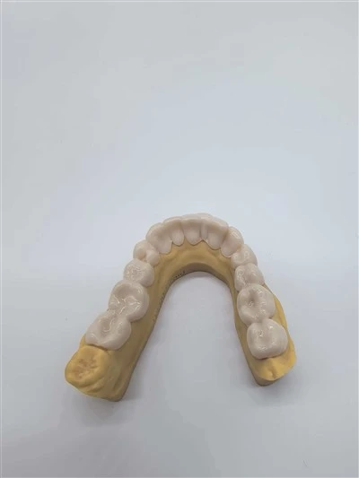 Snap On Smile Cheap Price Good Quality