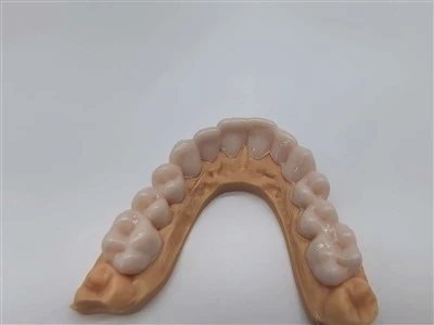 Snap On Smile Outsourcing China Supplier