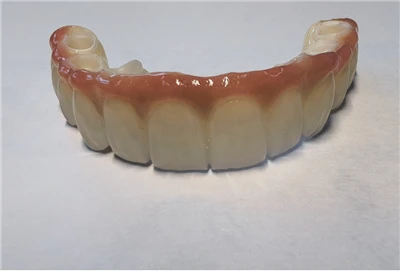 Zirconia Implant Bridge Full Arch China Dental Lab