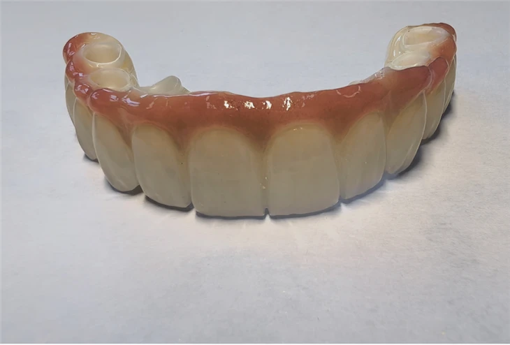 Zirconia Implant Bridge Full Arch China Dental Lab